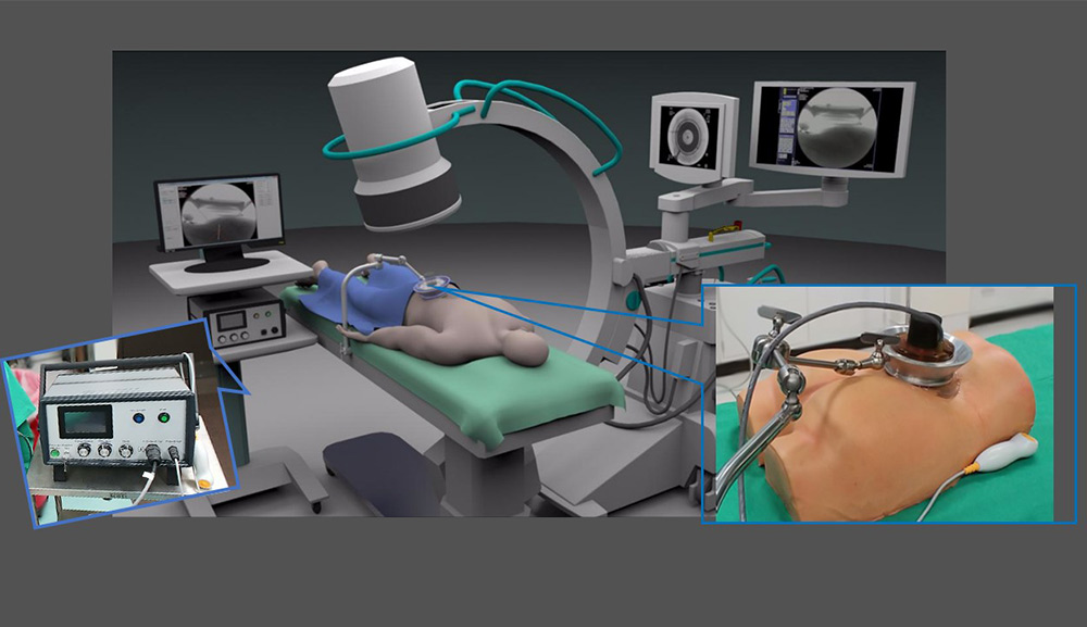 Non-Invasive HIFU for Low Back Pain Treatment | Unika Medical Centre