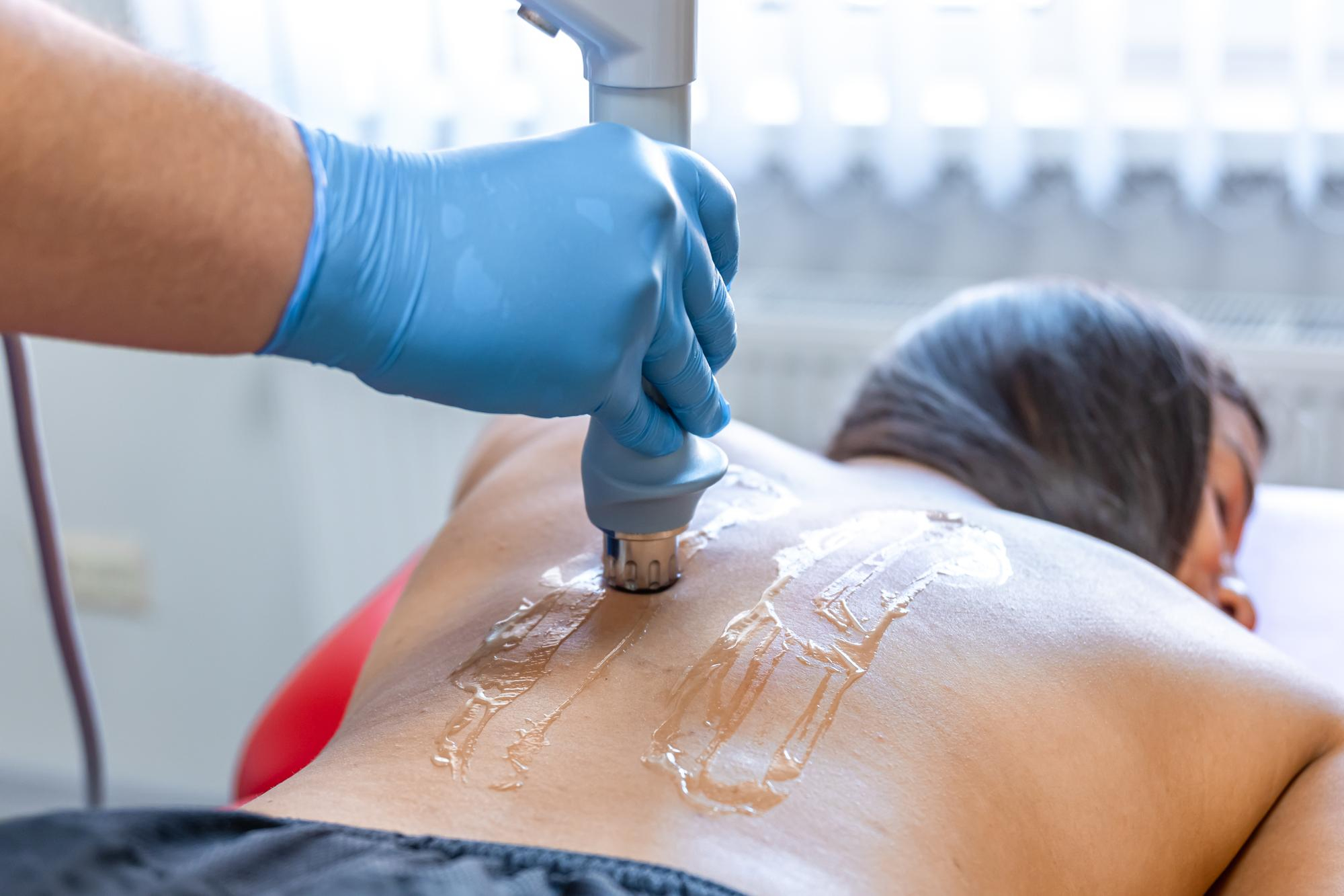 HIFU therapy back pain