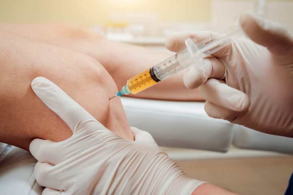 PRP injections timeline