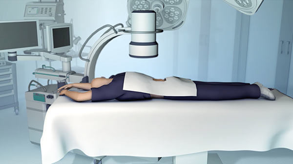 Intradiscal Ozone Therapy treatment