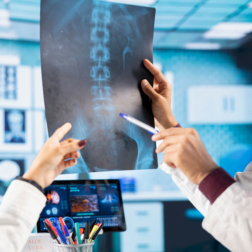 UNIKA Medical Centre | Minimally Invasive Spine Treatments
